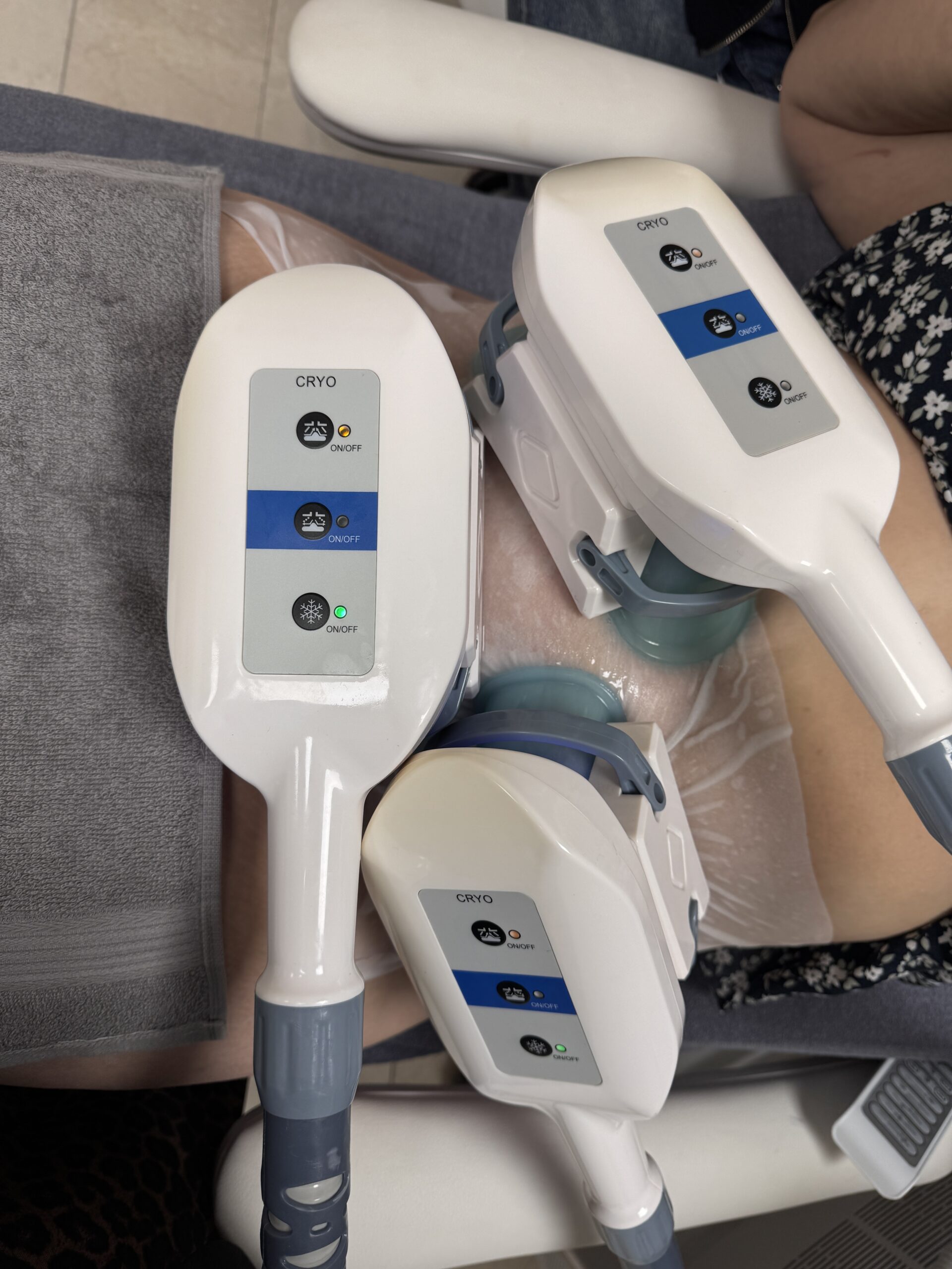 Kryolipolyse Behandlung